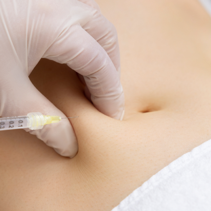 Acnelan Treatment