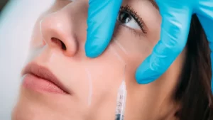 Dermal Fillers