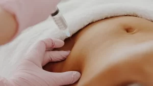 Lipolysis