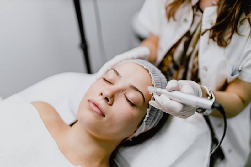 Does microneedling improve skin?