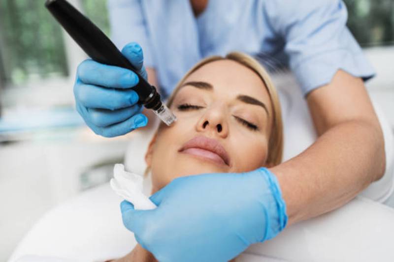 How does microneedling work?