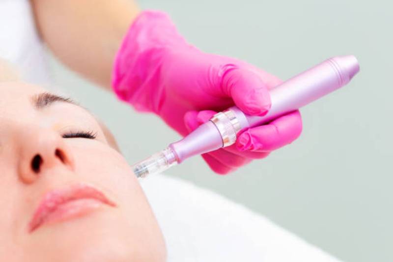 Is microneedling very effective?