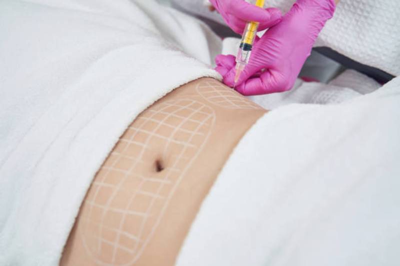 What is the best treatment for body contouring?