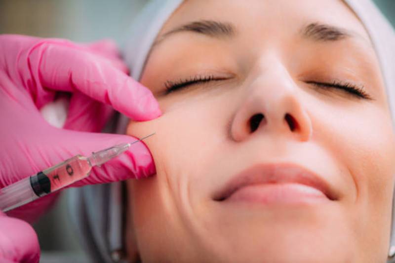 What does dermal filler do?