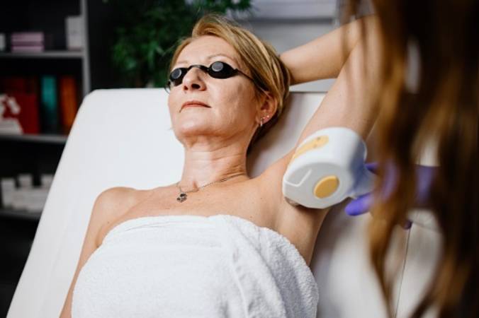 What are the negative effects of laser hair removal?