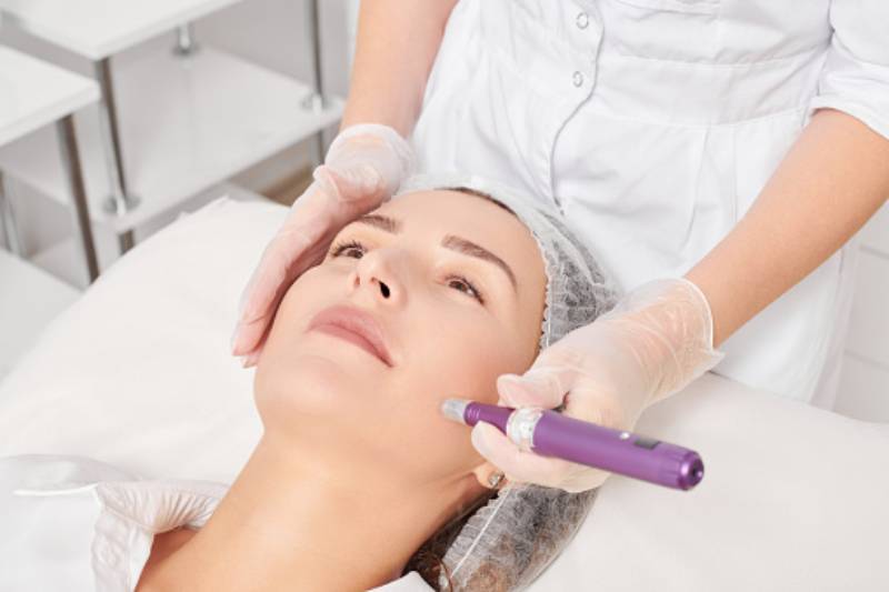 Microneedling or Laser Skin Resurfacing: Which Is Better?