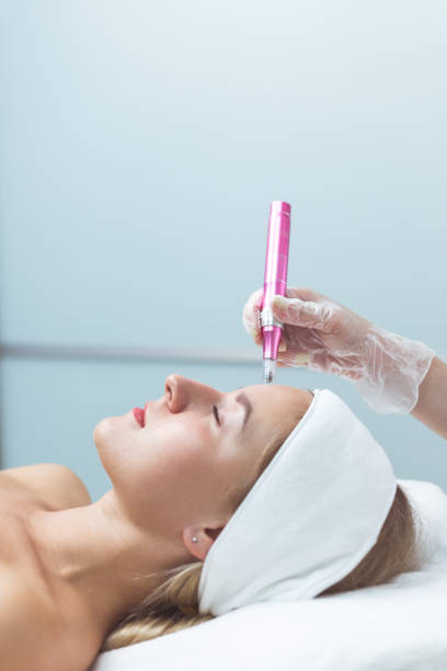 How frequently should you be microneedling?