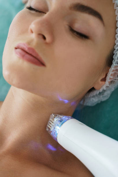 Who should avoid microneedling?