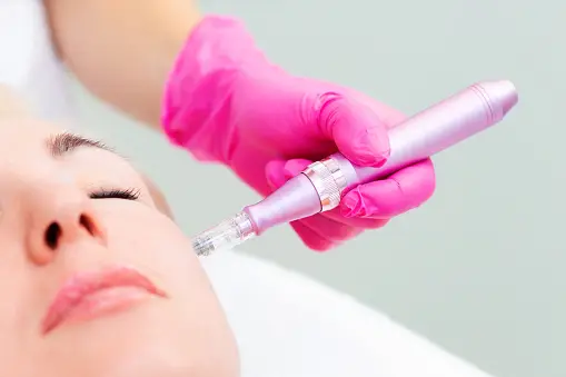 How many sessions of microneedling do I need for acne scars?