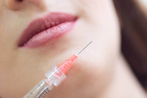 Can you stop fillers once you start?