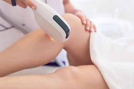 Can you get HPV from laser hair removal?