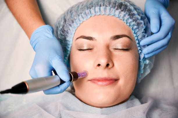 Can microneedling be done everyday?