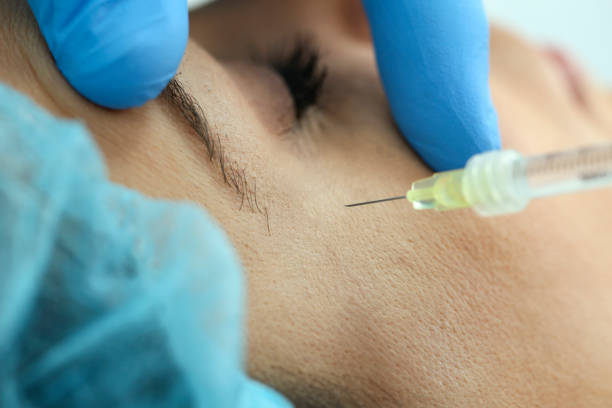 What is the difference between anti-wrinkle injections and fillers?