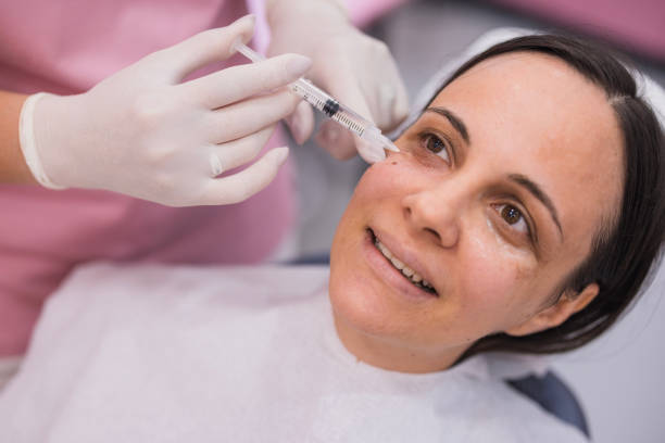 Does microneedling remove dark circles?