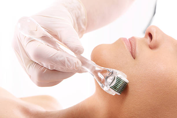 What is the science behind microneedling?