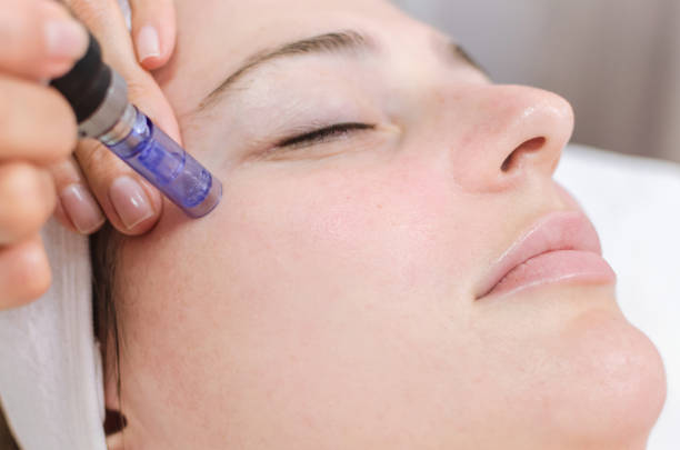 What happens if you do microneedling too often?