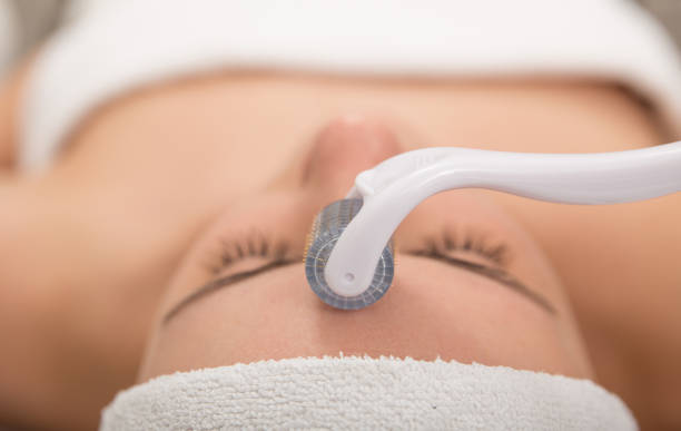 How to speed up microneedling healing?