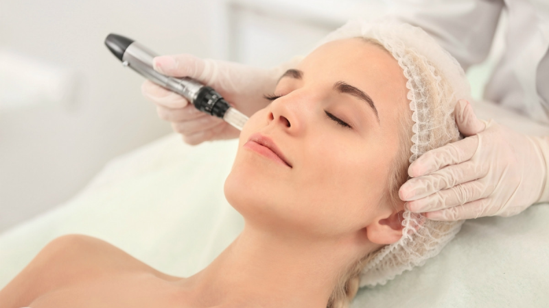 Combined microneedling Toronto price for face and neck treatments. 