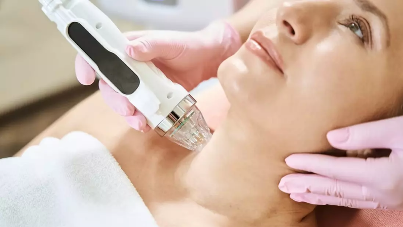 Microneedling cost Toronto varies based on treatment area selection.