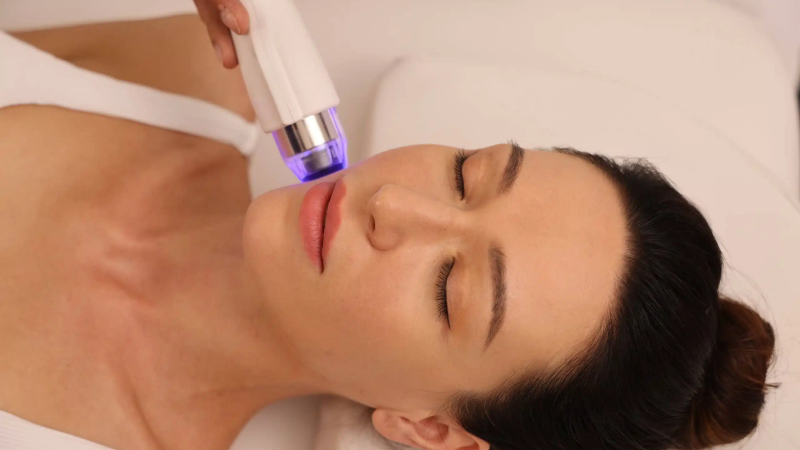 Microneedling Toronto price for full face treatment sessions. 