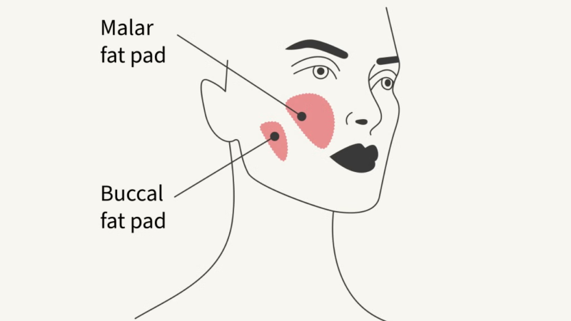 Buccal fat removal Toronto clinic selection guide.