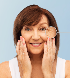 Age Spot Removal