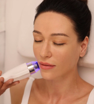 RF Microneedling