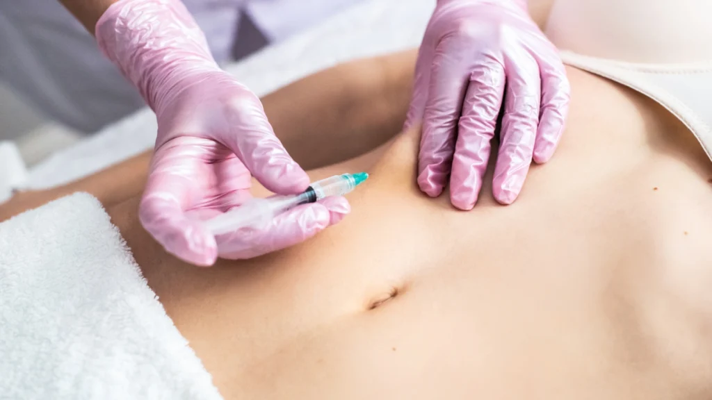 Poly L lactic acid fillers in dermal fillers toronto price.