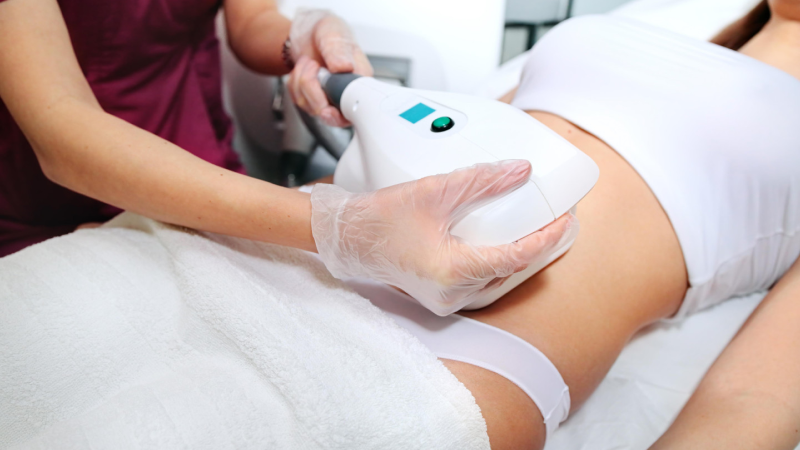 Cost of cool sculpting Toronto for abdomen treatment.