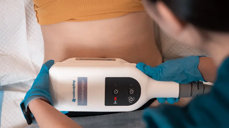 Cost of cool sculpting Toronto for arms.