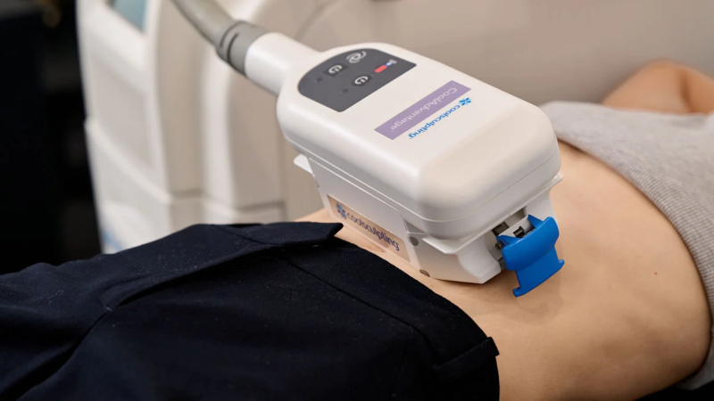 Cool sculpting cost Toronto pricing factors.