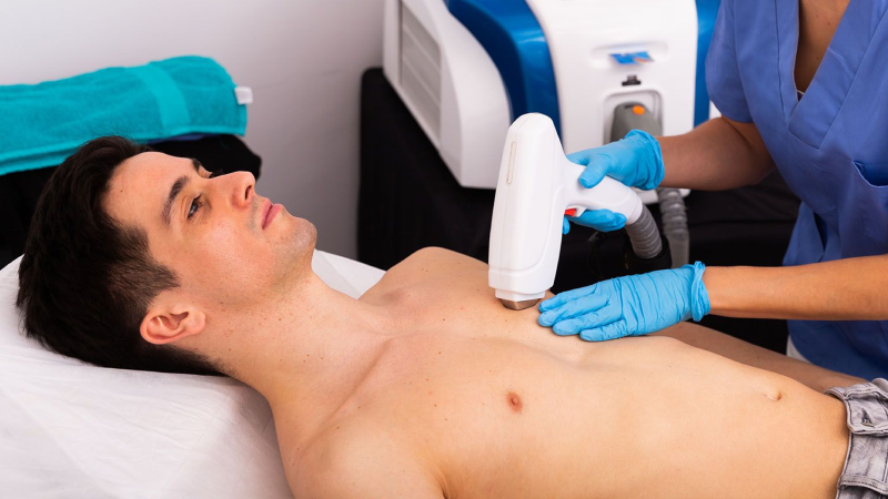 laser hair removal cost toronto chest treatment session