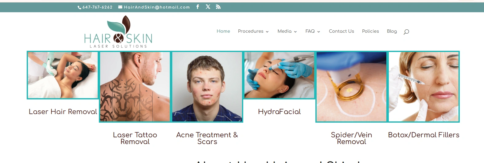 Laser hair removal Etobicoke Toronto Hair and Skin