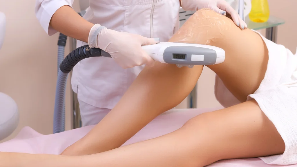Laser hair removal technologies used by top clinics in Etobicoke, Toronto.