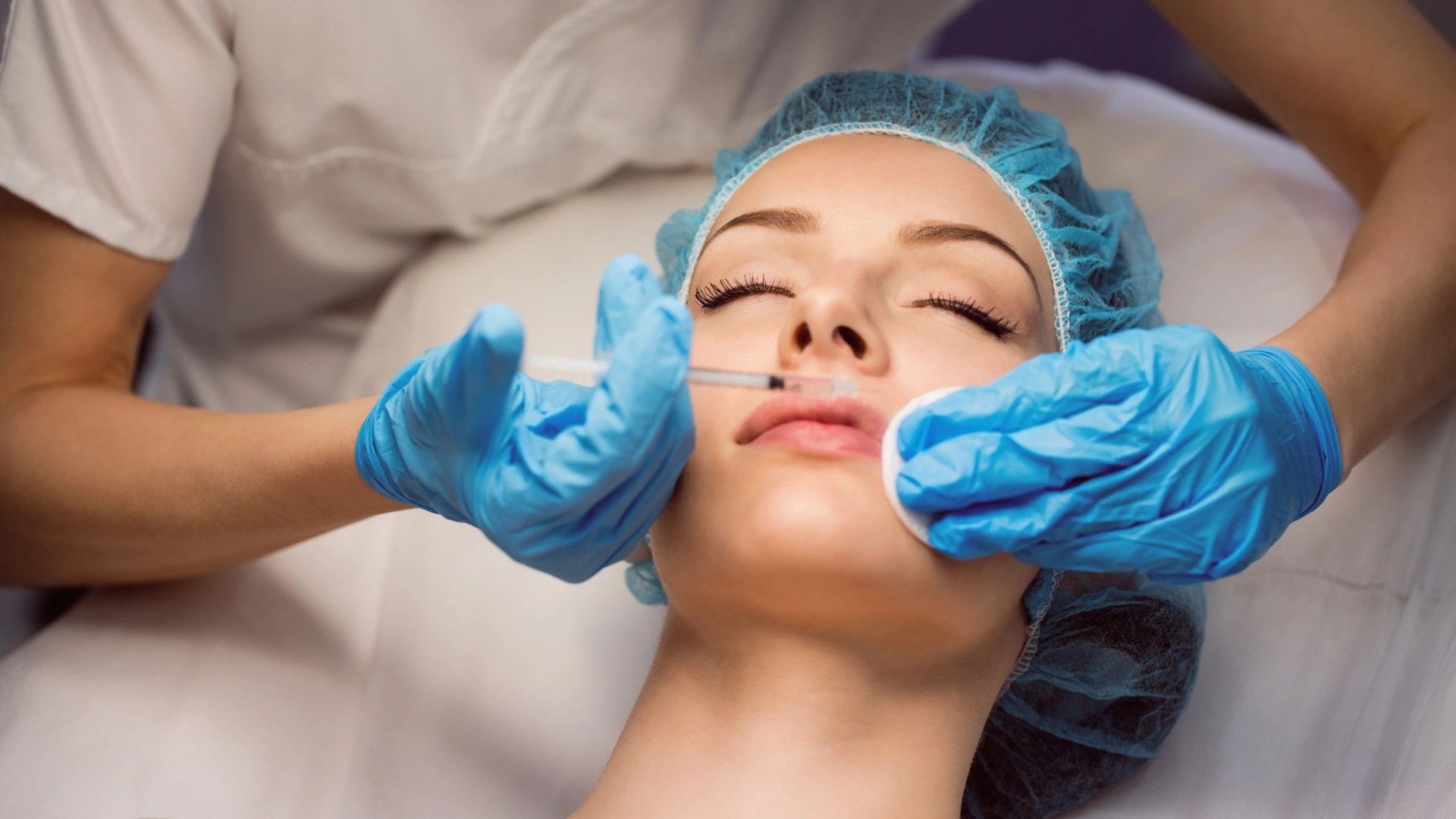 Lip Fillers