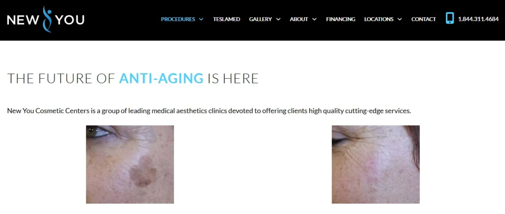 New you serves as the best clinic for botox Toronto Yorkville area.