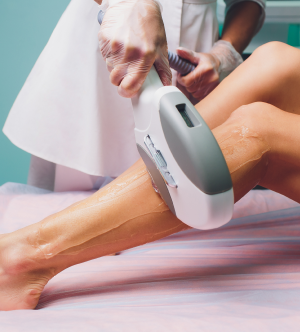 Permanent Laser Hair Removal