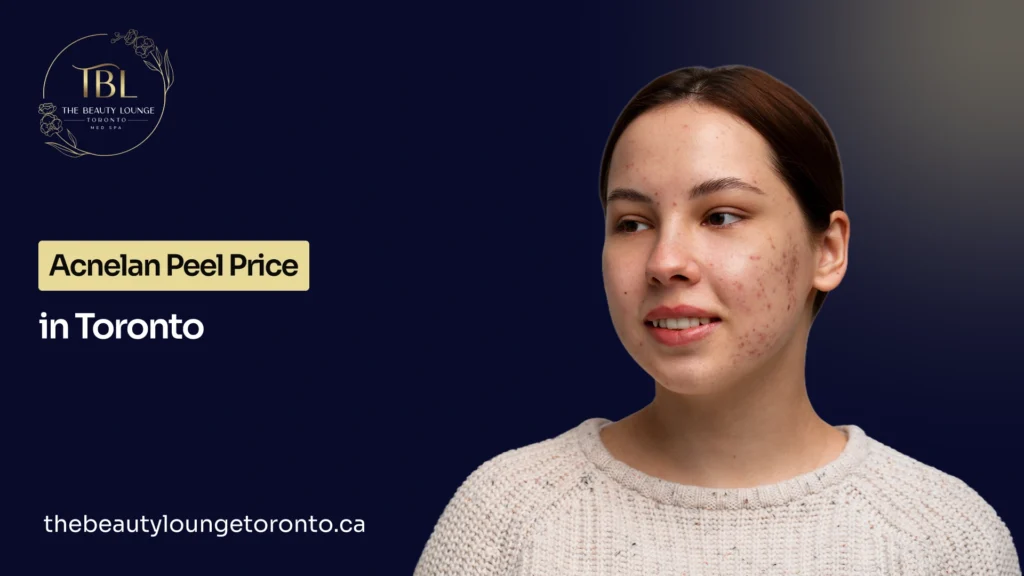 Acnelan Peel Price in Toronto: Cost Guide for 2026
