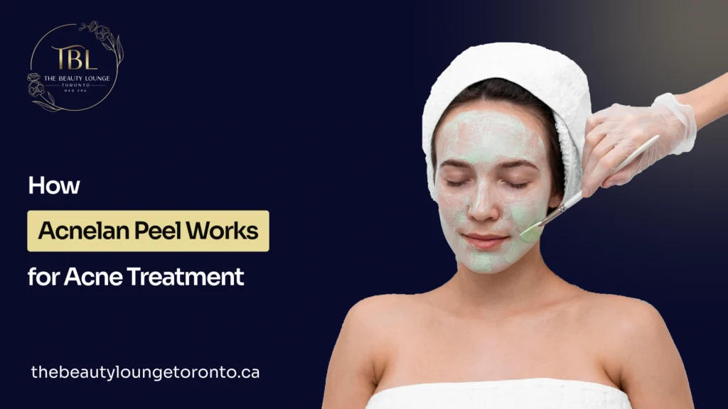 Guide acnelan peel procedure for acne treatment and skin clarity improvement.