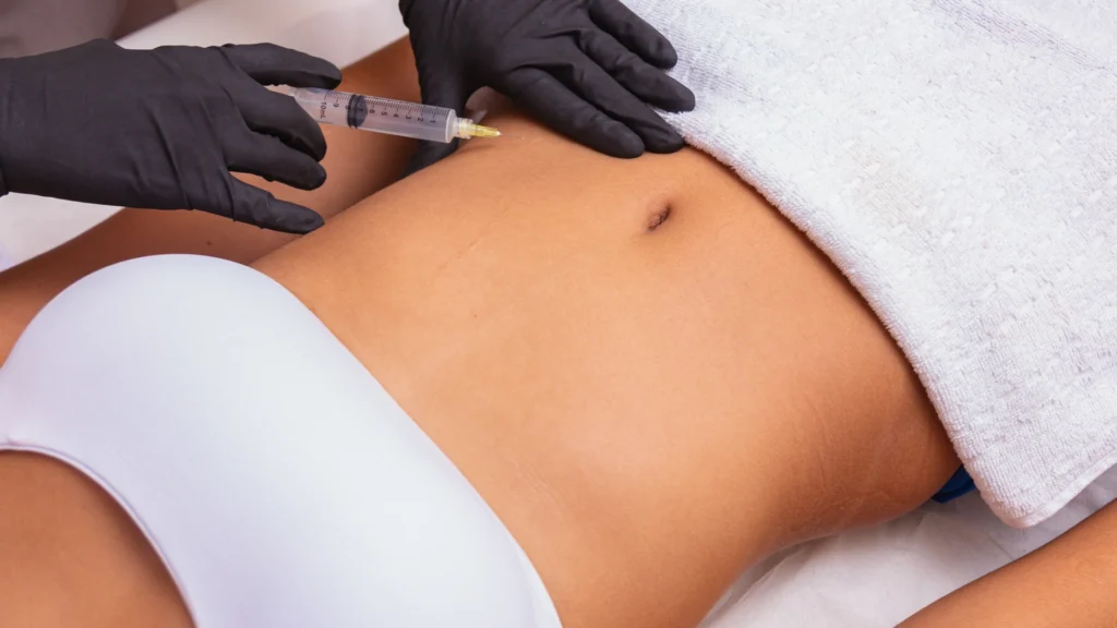 Lipolysis procedure supporting fat-to-energy conversion.