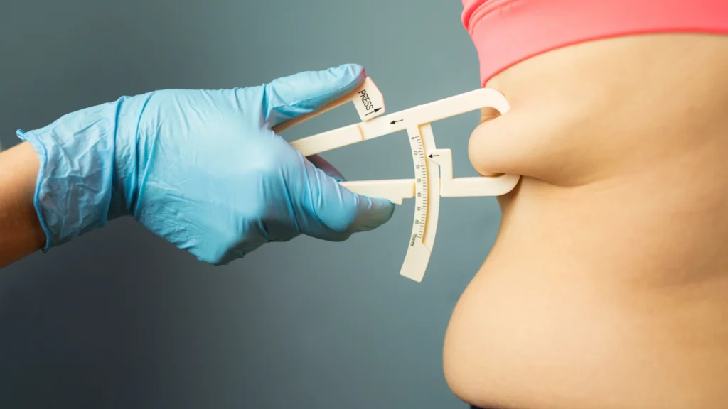 Factors that influence lipolysis treatment outcomes.