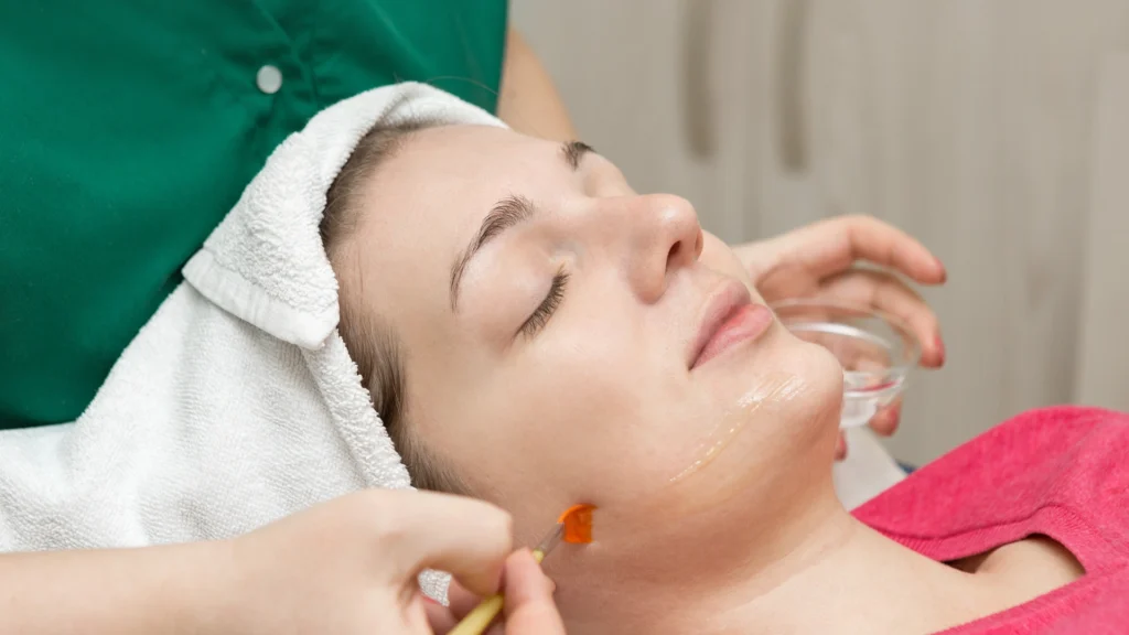 Learn about factors that influence the acnelan peel price in Toronto.