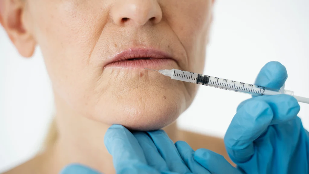 Lip flip botox price Toronto cost and pricing information.