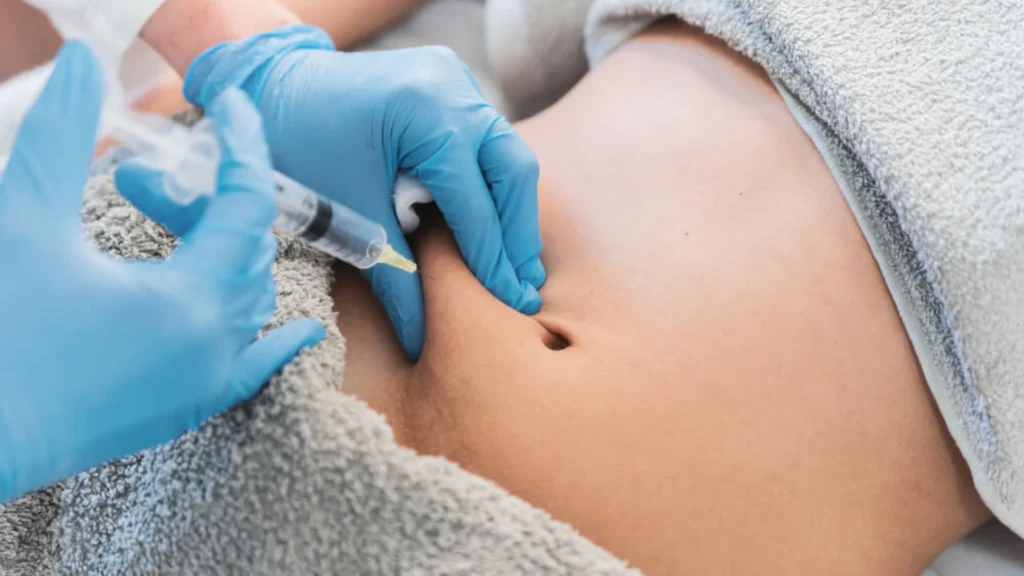 Preparation of the skin before the lipolysis procedure .