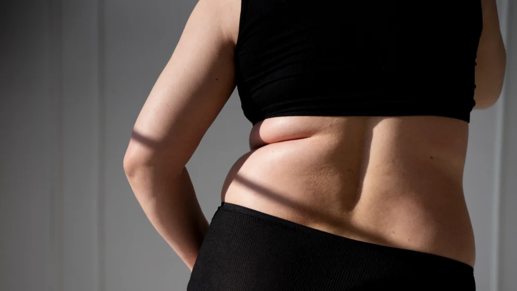 Adipose lipolysis in stubborn fat storage areas.