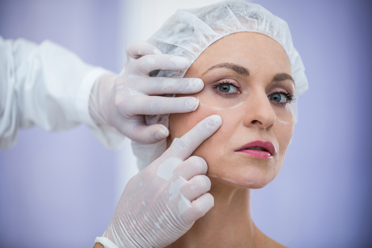 What Is RF Skin Tightening?