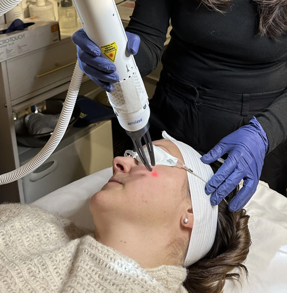 Aerolase Era Laser