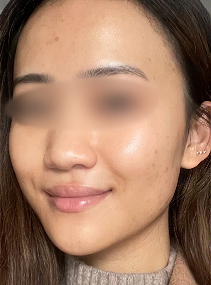 After