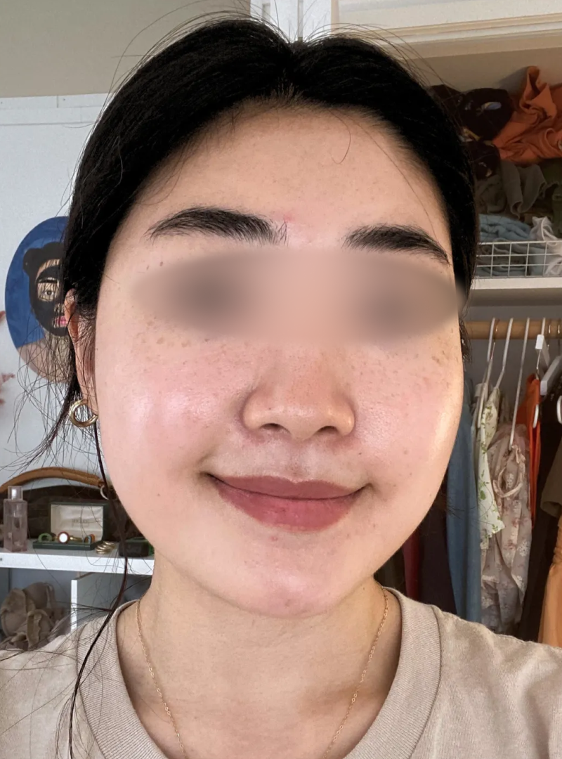 Before