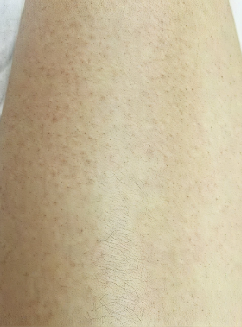 After